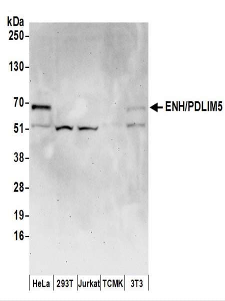 IHC-plus™ PDLIM5 / LIM Antibody (aa546-596)