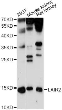 Polyclonal Rabbit anti-Human LAIR2 / CD306 Antibody (WB)