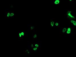 RUNX1T1 / ETO Antibody (clone OTI1H1)