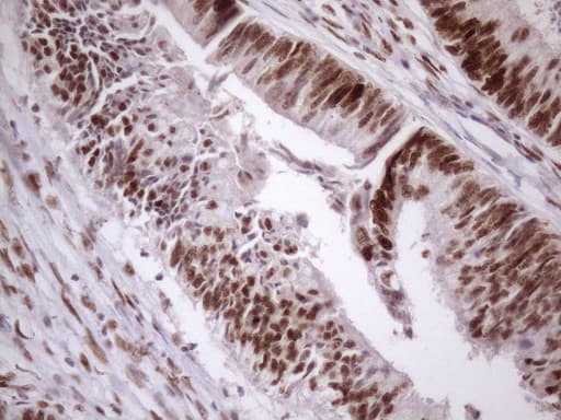 TP53BP1 / 53BP1 Antibody (aa1-300, clone OTI2H6)