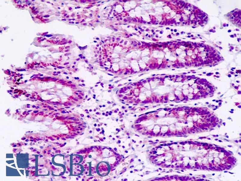IHC-plus™ MAN2A2 / Alpha-Mannosidase II Antibody (aa767-796)