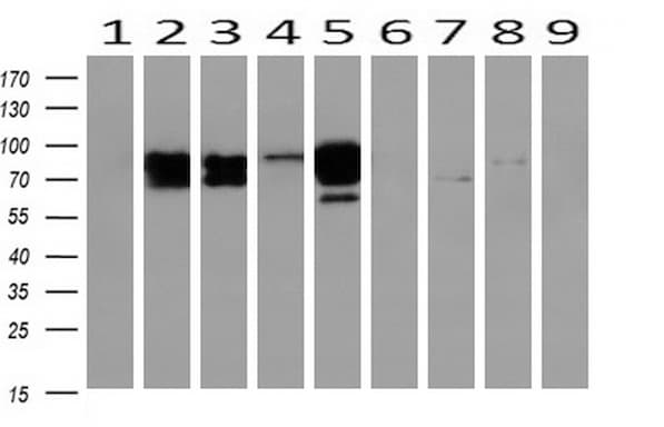 CTNNB1 / Beta Catenin Antibody (clone OTI3F9)