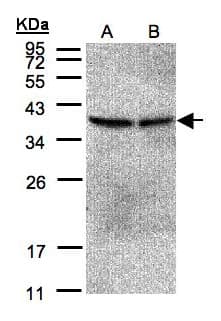 PP2CB / PPP2CB Antibody