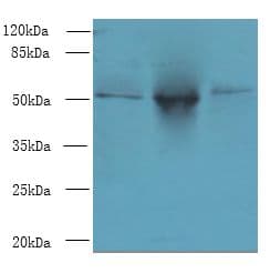 TRIML1 Antibody