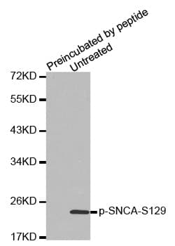 SNCA / Alpha-Synuclein Antibody (phospho-Ser129)