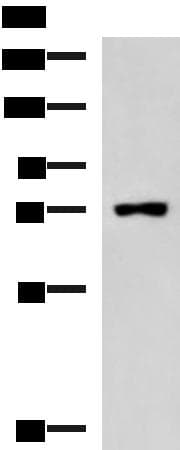 KIAA0020 / PEN Antibody