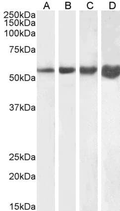 IHC-plus™ Polyclonal Goat anti-Human DES / Desmin Antibody (aa454-468, IHC, WB)