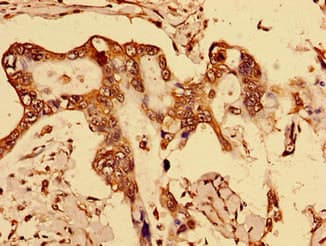 DOK1 Antibody