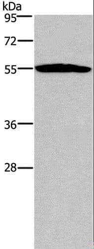 SERPINA1 / Alpha 1 Antitrypsin Antibody