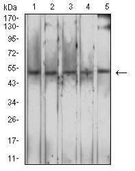 MSR1 / CD204 Antibody (clone 5B8H4)