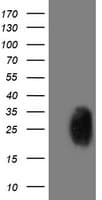 PGAM2 Antibody (clone OTI2F5)