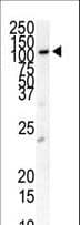 CD135 / FLT3 Antibody (aa33-64)