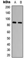 Polyclonal Rabbit anti-Human ADAM8 Antibody (Internal, WB)