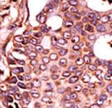 Polyclonal Rabbit anti-Human SEPHS2 Antibody (aa171-201, IHC, WB)