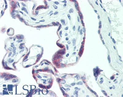 IHC-plus™ Polyclonal Rabbit anti-Human PAPPA / PAPP-A Antibody (IHC)