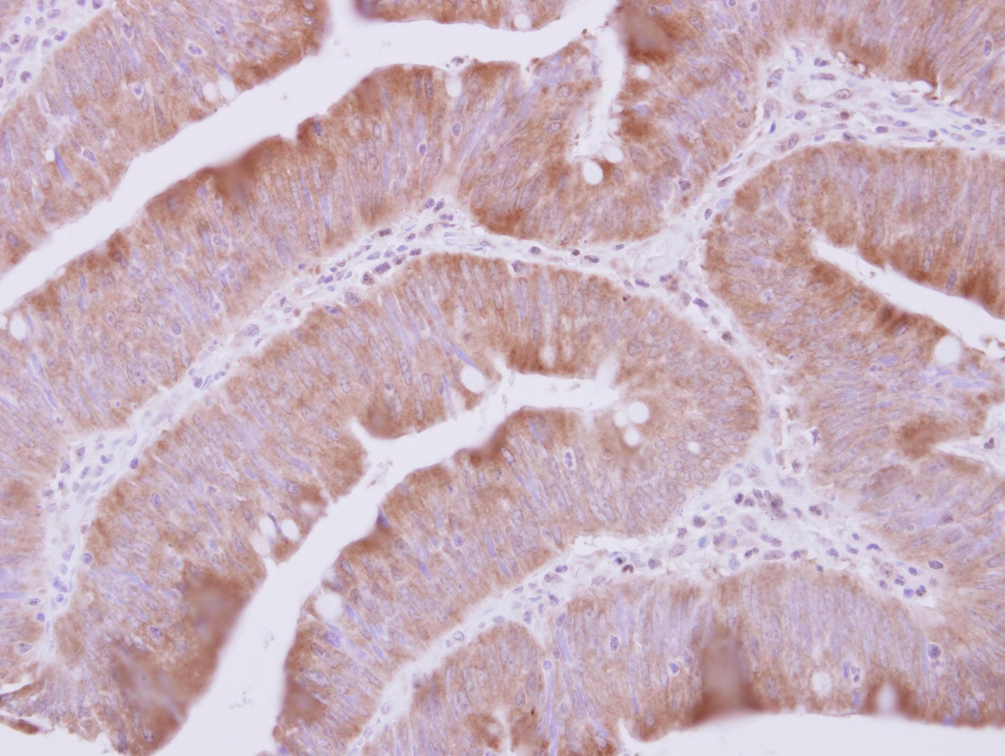 Polyclonal Rabbit anti-Human GLNRS / QARS Antibody (Internal, IHC, WB)