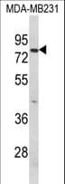 Polyclonal Rabbit anti-Human RANBPM Antibody (aa339-367, IHC, WB)