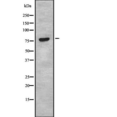 DCLK / DCLK1 Antibody