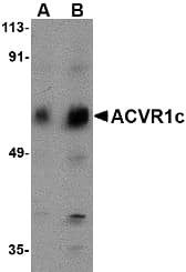 IHC-plus™ ACVR1C / ALK7 Antibody