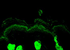 IHC-plus™ CALR / Calreticulin Antibody