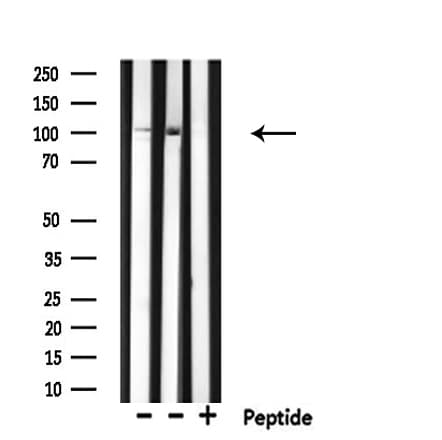 Arkadia / RNF111 Antibody