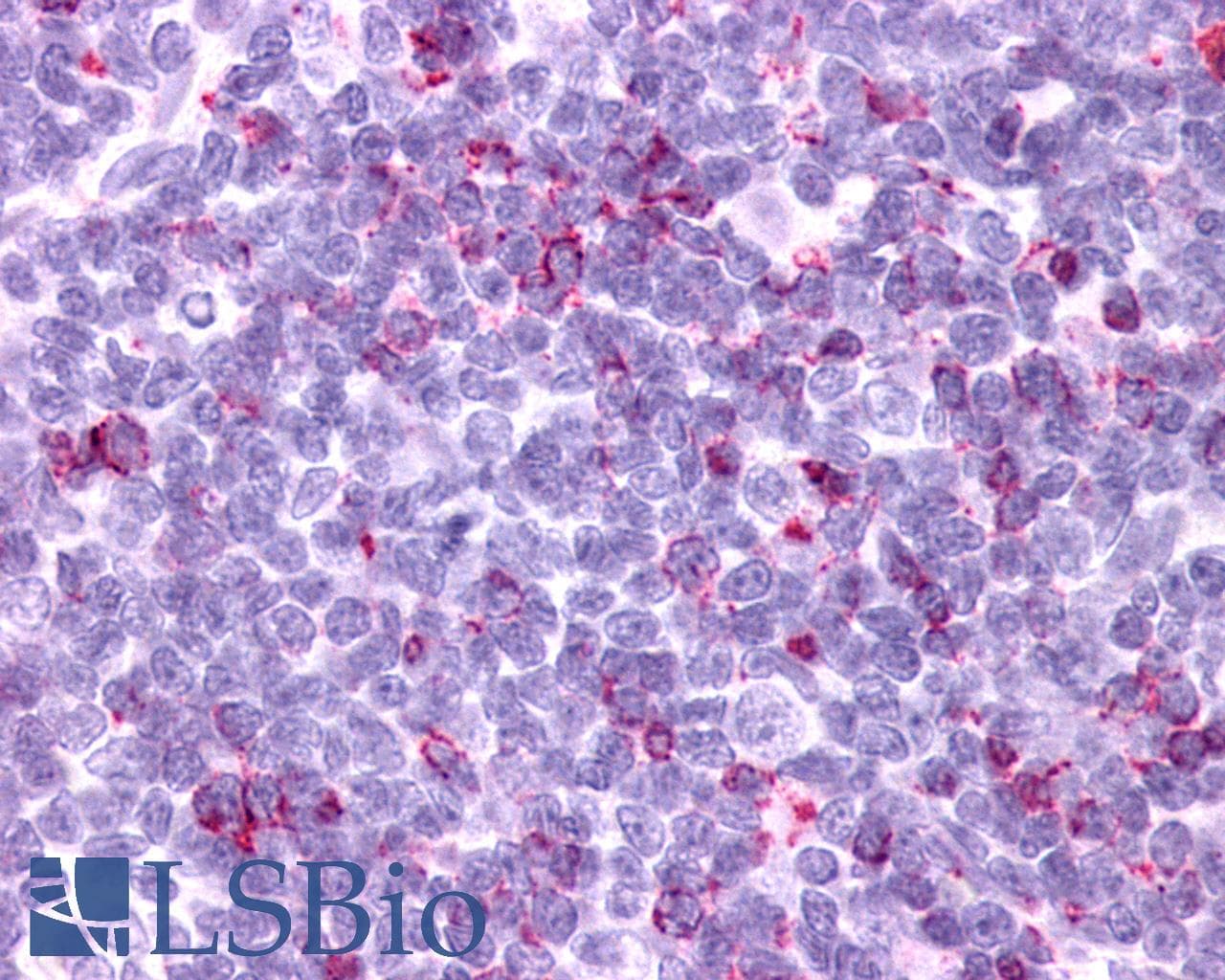 PathPlus™ Polyclonal Rabbit anti-Human GPR34 Antibody (Cytoplasmic Domain, IHC)