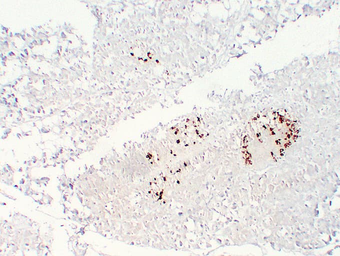 Monoclonal Mouse anti-Human SST / Somatostatin Antibody (clone ABT-SST, IHC)