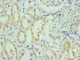 Polyclonal Rabbit anti-Human SLC39A6 / LIV-1 Antibody (aa170-320, IHC, WB)
