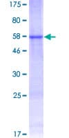 Human PRPK / TP53RK Protein (Recombinant GST)