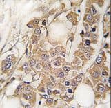 Vimentin Antibody (Ser82)