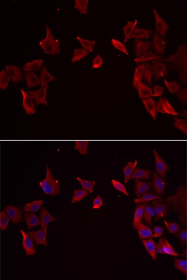 IHC-plus™ RAMP3 Antibody