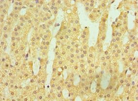HSD11B1 / HSD11B Antibody (aa25-292)