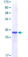 Human METRN / Meteorin Protein (Recombinant GST, N-terminus)