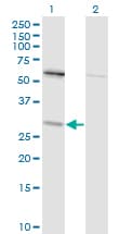 TPMT Antibody (clone 1B5)