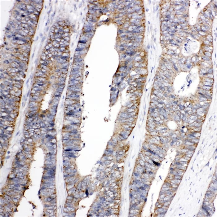 TRPC3 Antibody (aa836-851)