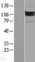 Human MOV10 Protein (Over-Expression Lysate Myc-DDK (Flag))