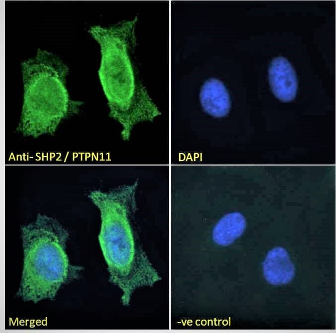 IHC-plus™ Polyclonal Goat anti-Human PTPN11 / SHP-2 / NS1 Antibody (aa584-597, IHC, IF, WB)