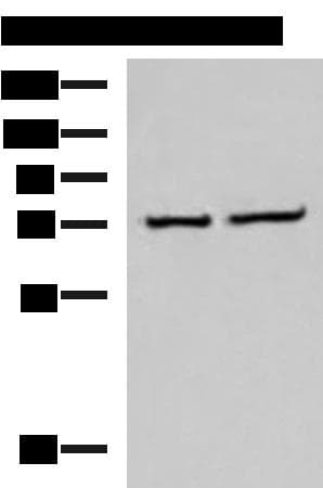 Polyclonal Rabbit anti-Human CSTF3 Antibody (WB)