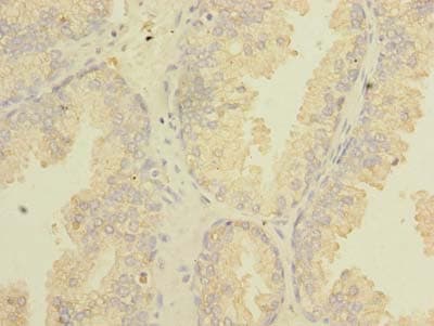 Polyclonal Rabbit anti-Human TSGA10 Antibody (IHC, WB)