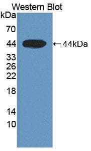 CFB / Complement Factor B Antibody (aa35-160)
