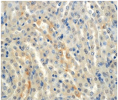 SCNN1A / ENaC Alpha Antibody (clone 2G4)
