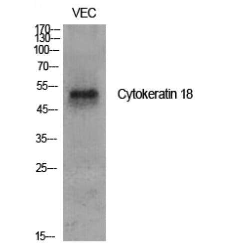 Polyclonal Rabbit anti-Human KRT18 / CK18 / Cytokeratin 18 Antibody (10-90 aa, IHC, IF, WB)