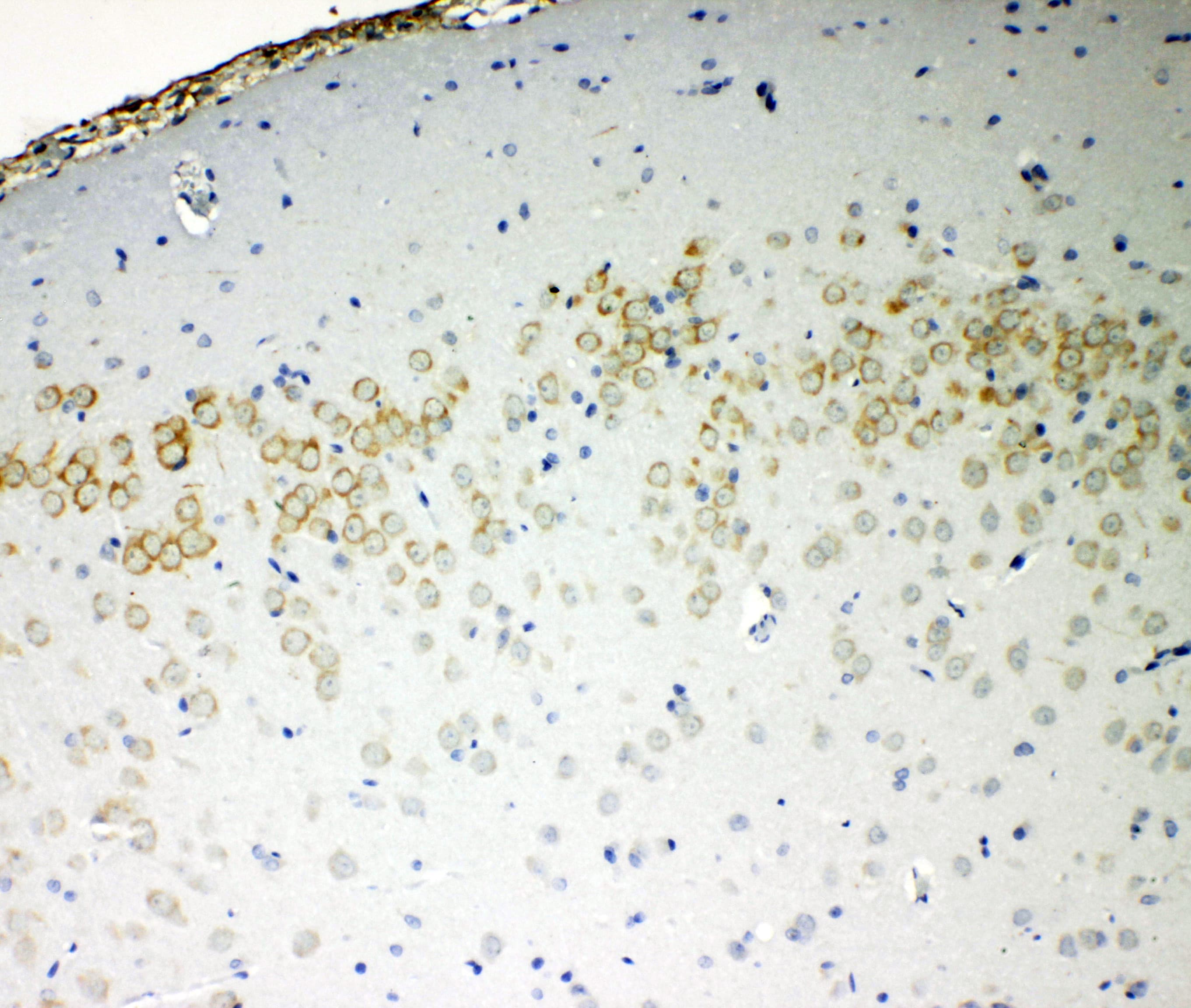 CD144 / CDH5 / VE Cadherin Antibody (aa766-784)
