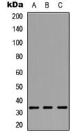 PathPlus™ CNN1 / Calponin Antibody (Internal)