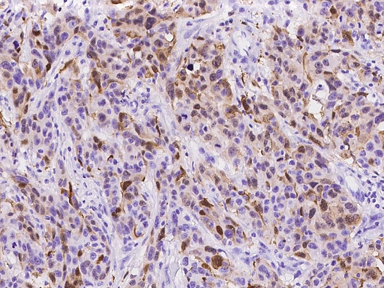 S100A8 / MRP8 Antibody (clone 236, Preservative Free)