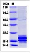 Human IL17A Protein (Recombinant His,N-terminus)