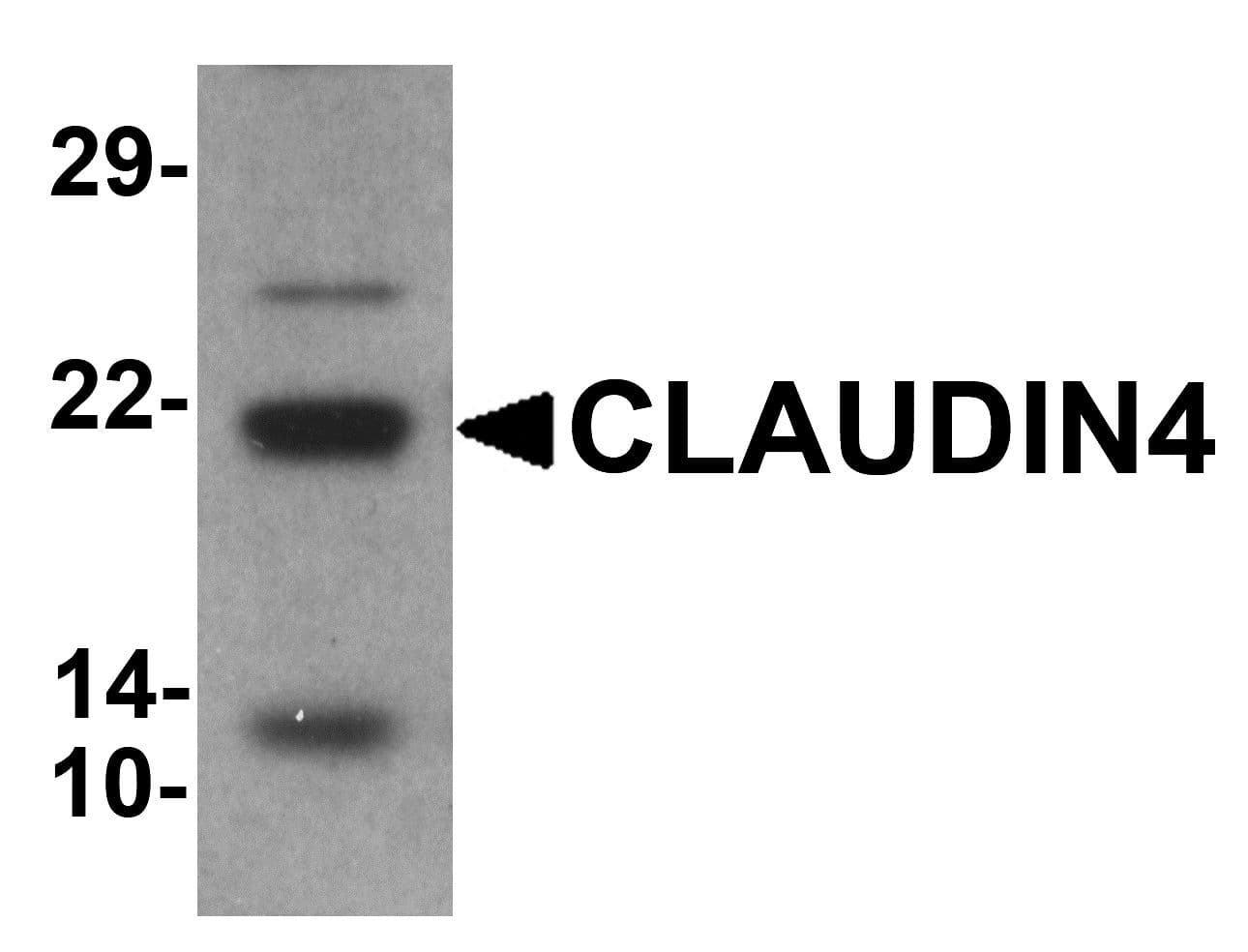 IHC-plus™ CLDN4 / Claudin 4 Antibody