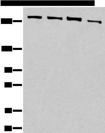 PRPF8 Antibody