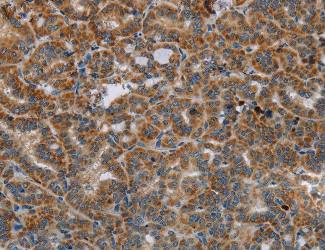 HSD17B14 Antibody