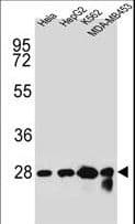 Polyclonal Rabbit anti-Human CHPT1 Antibody (aa7-33, WB)
